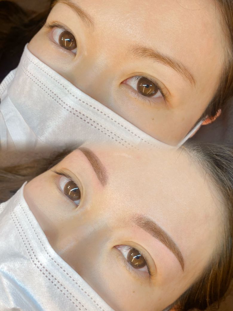 あいり 施術例1