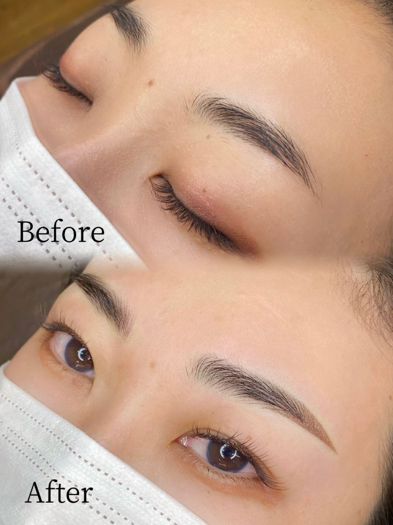 あいり 施術例2