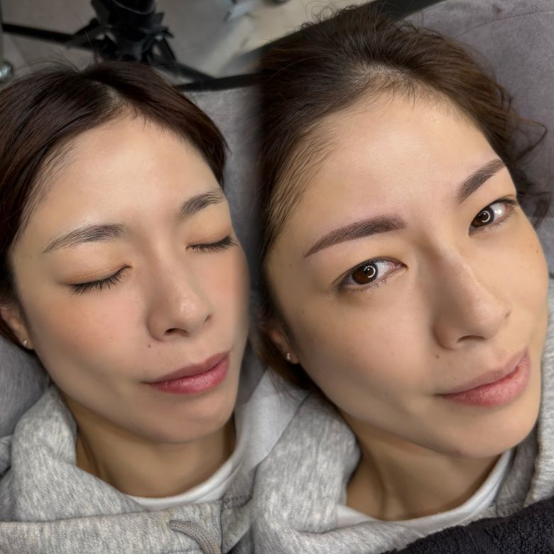 あいり 施術例3