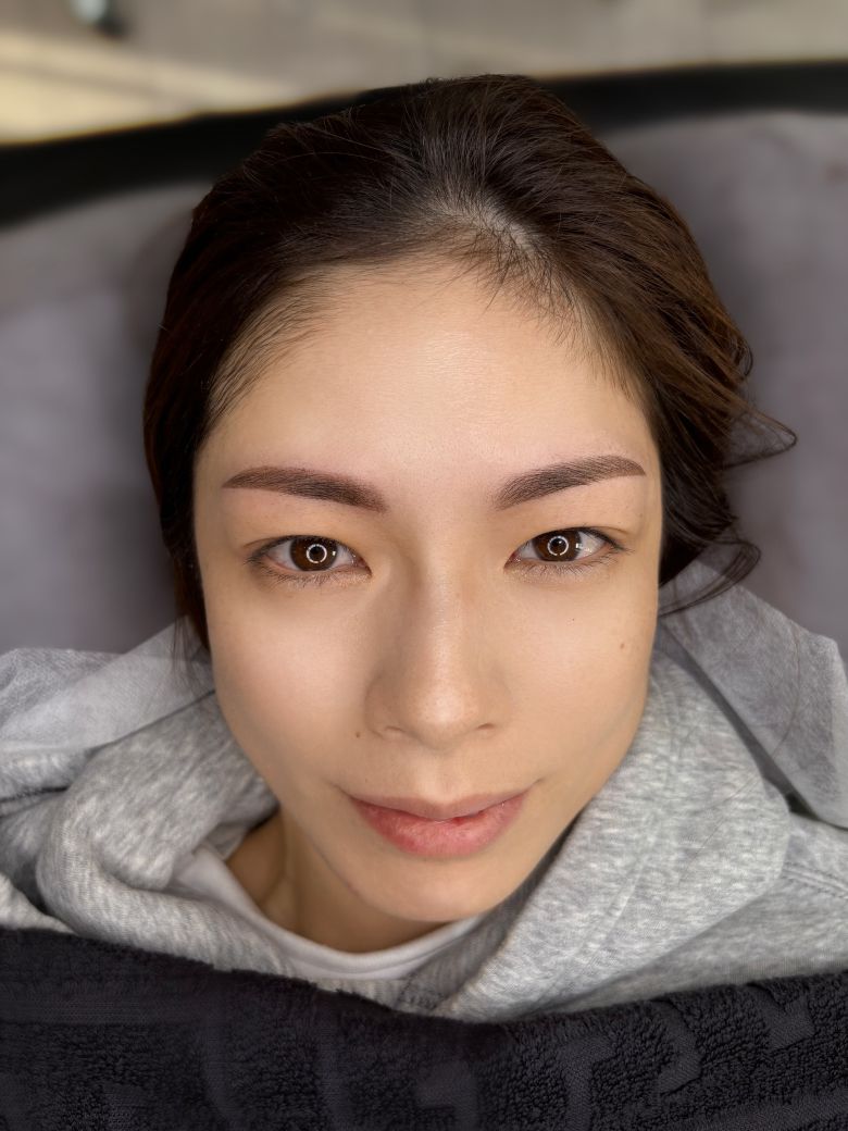 あいり 施術例4