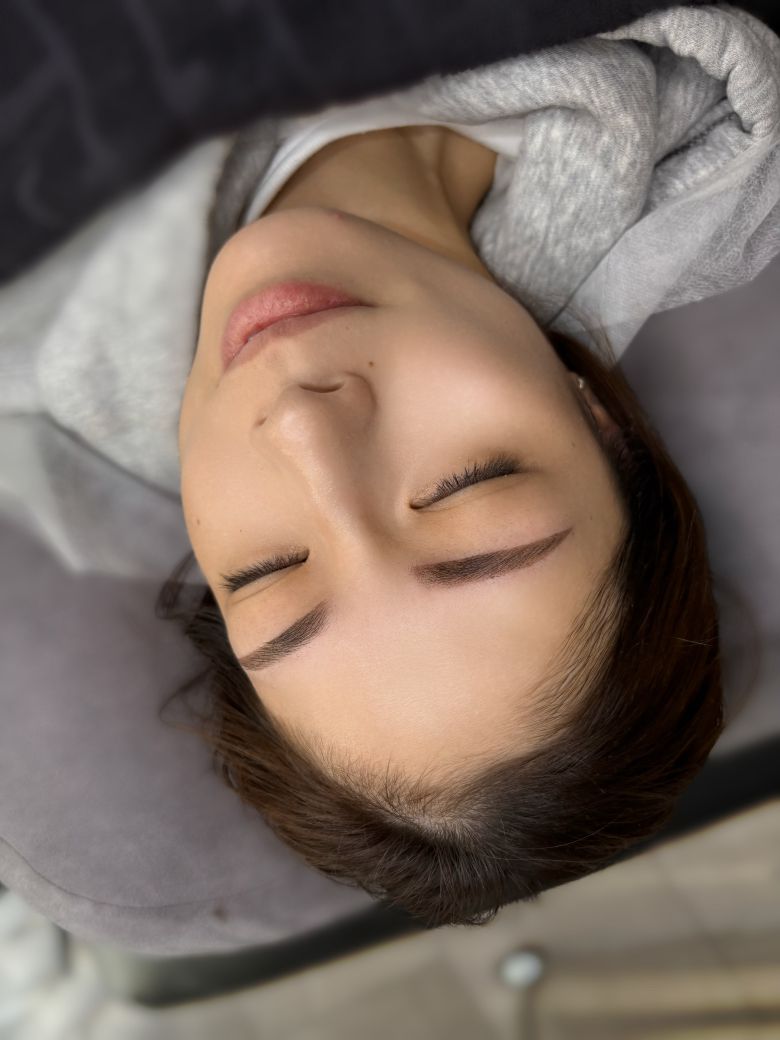 あいり 施術例5