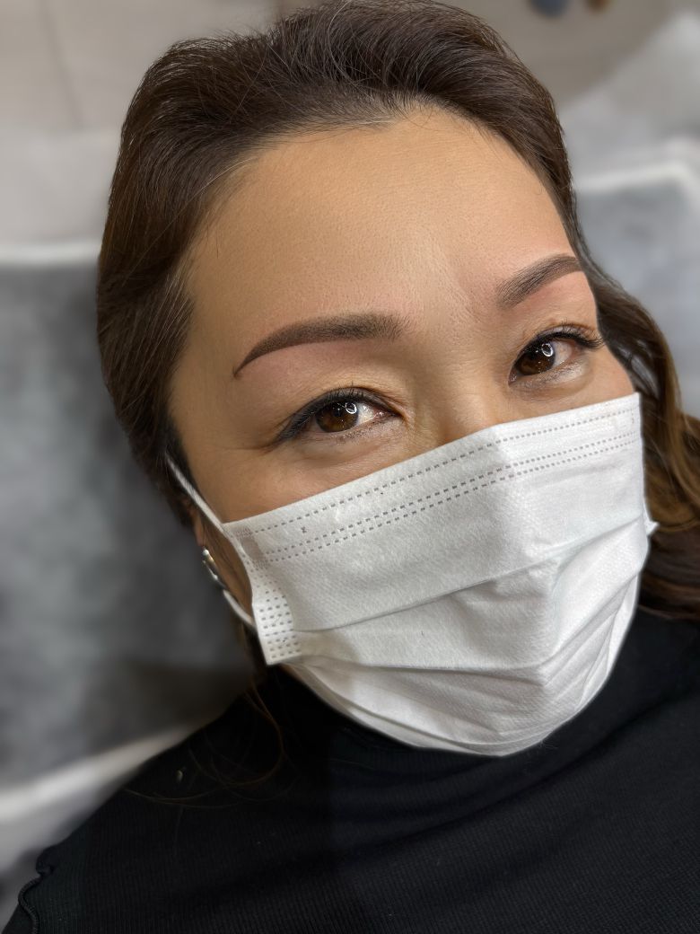 あいり 施術例7