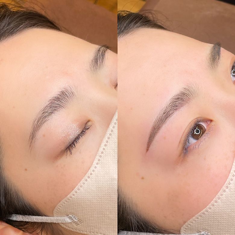 あめみや さやか 施術例2