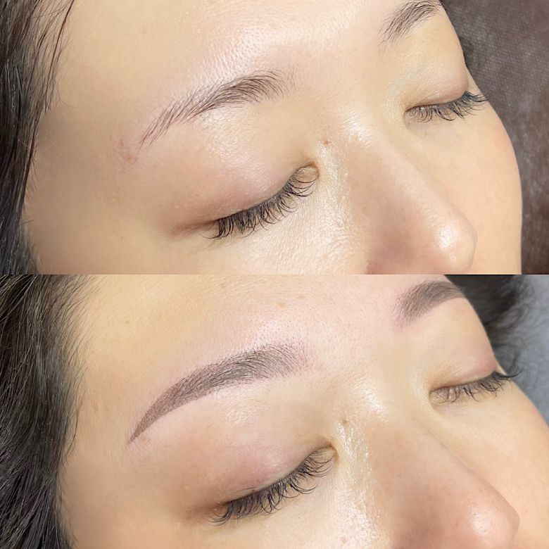 あめみや さやか 施術例3