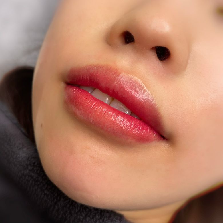 あめみや さやか 施術例4