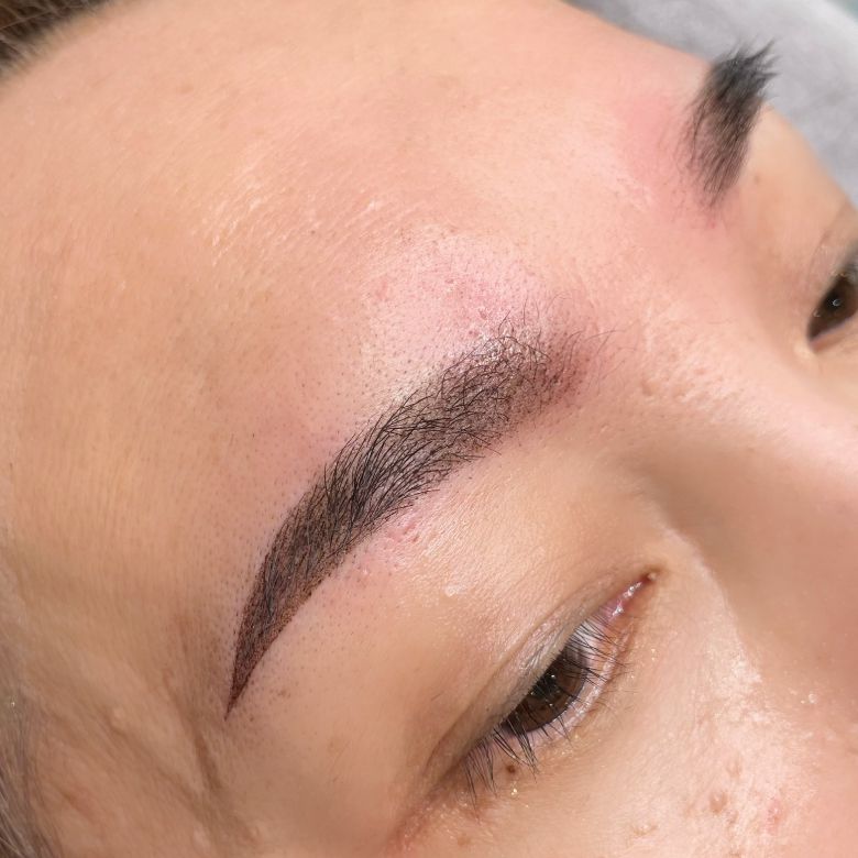 あめみや さやか 施術例5