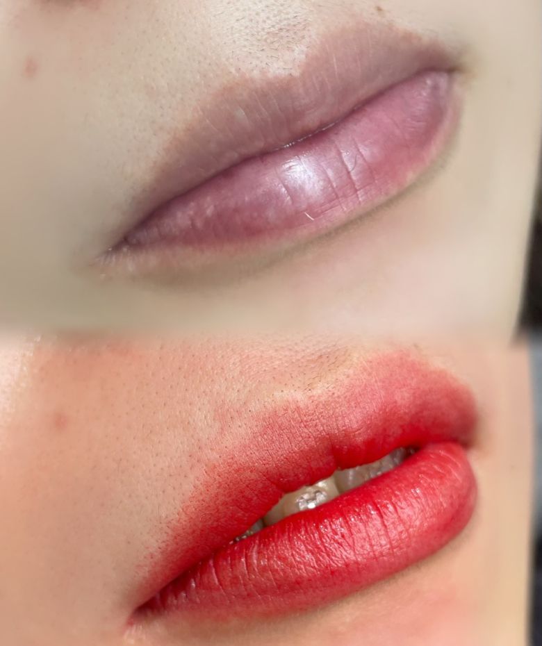 あめみや さやか 施術例7