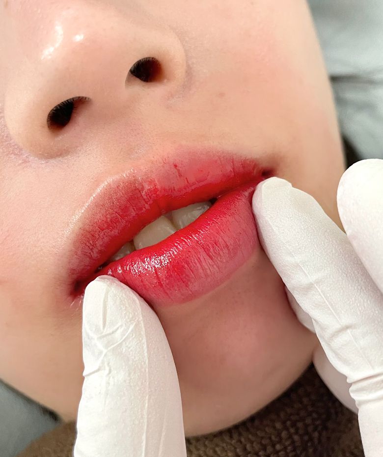 あめみや さやか 施術例8