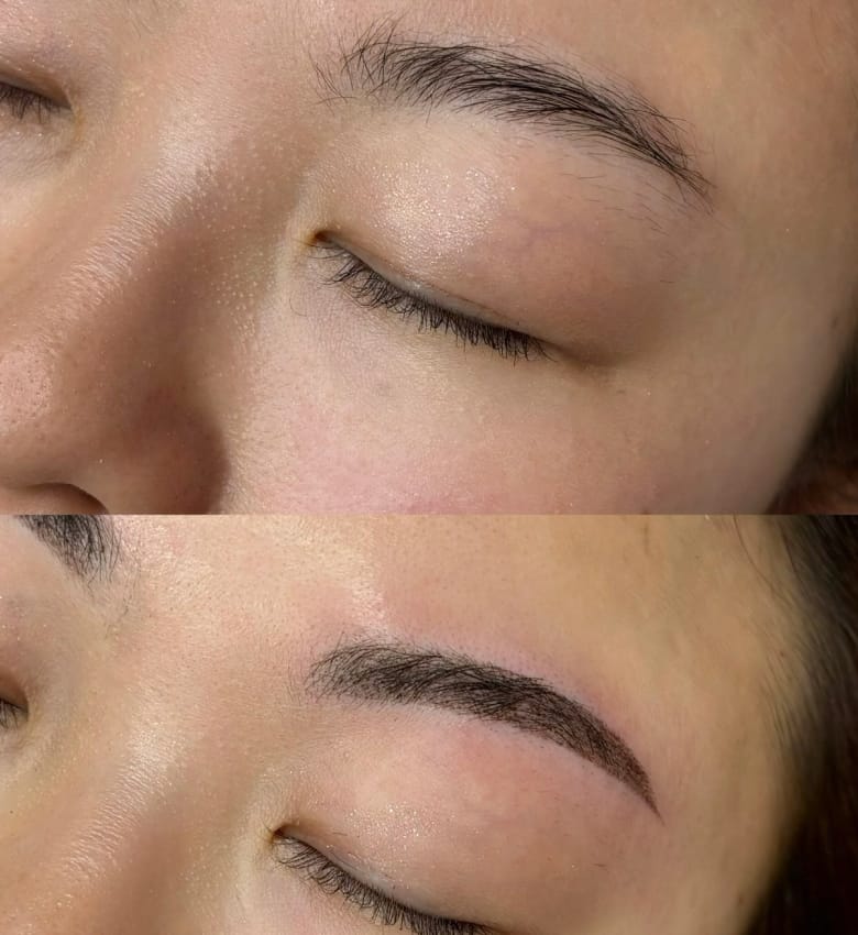 中野 ゆか 施術例3