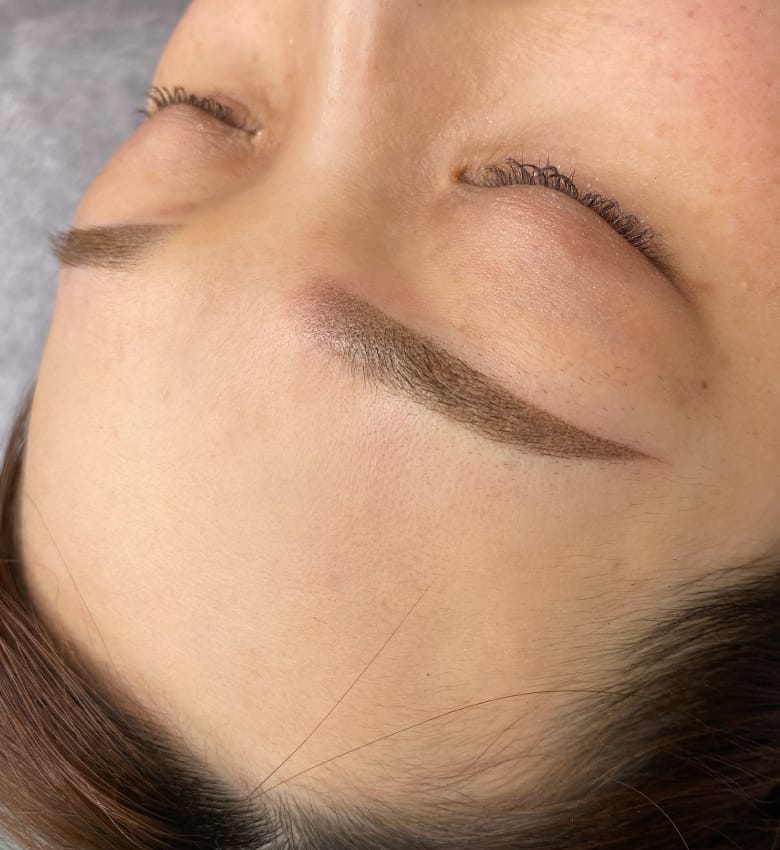 中野 ゆか 施術例4