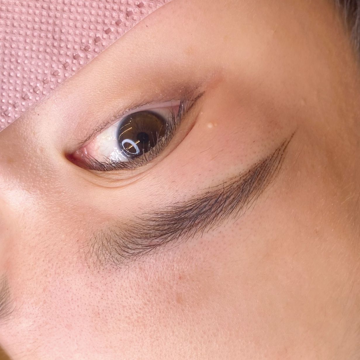 マシンストローク 施術例1