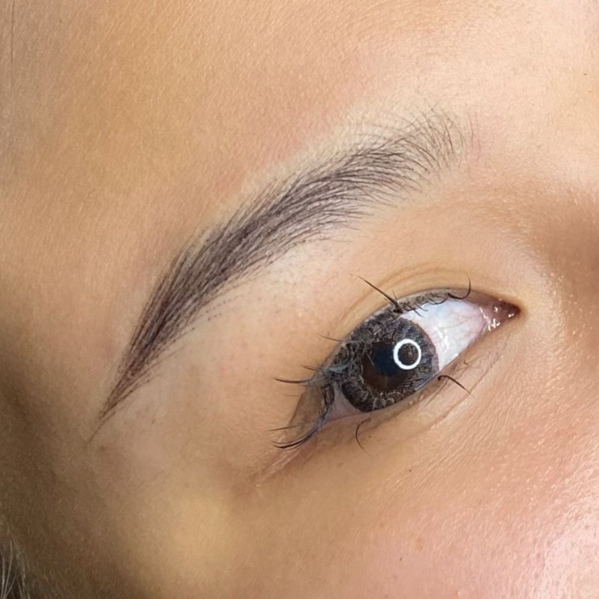 マシンストローク 施術例2