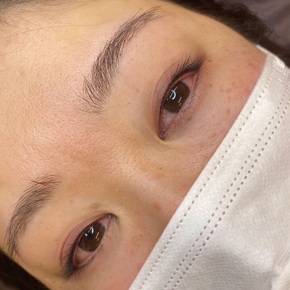 アイライン 施術例1