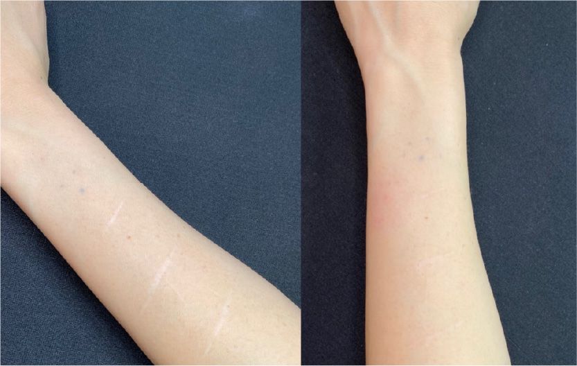 CASE2のBefore After