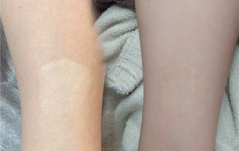 CASE3のBefore After