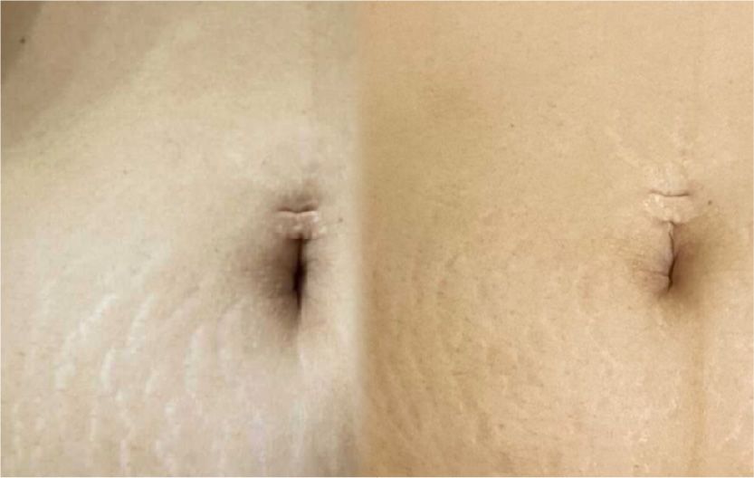 CASE4のBefore After