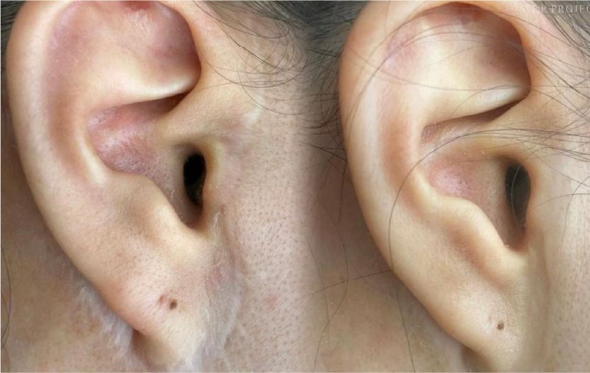 CASE5のBefore After