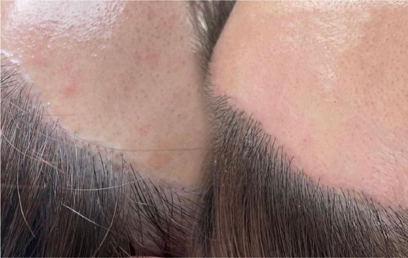 CASE6のBefore After