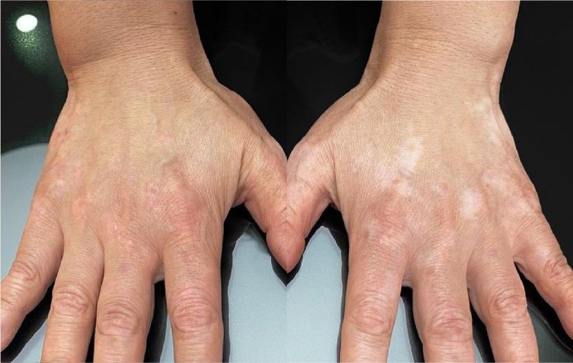 CASE7のBefore After