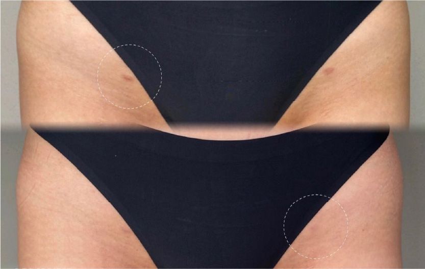 CASE8のBefore After