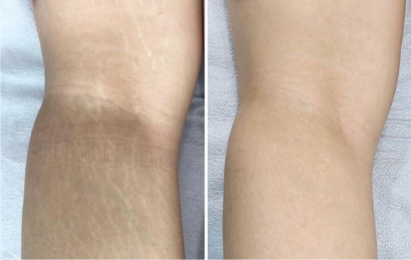 CASE9のBefore After