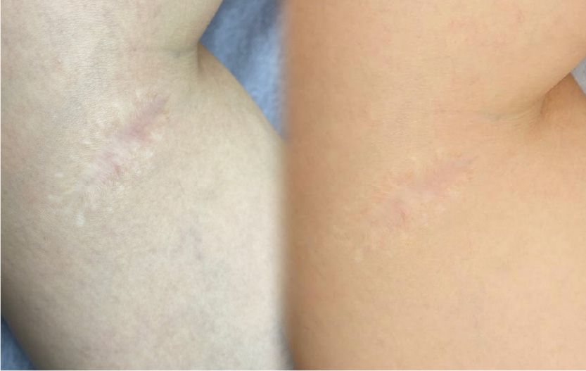 CASE11のBefore After