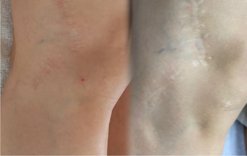 CASE12のBefore After