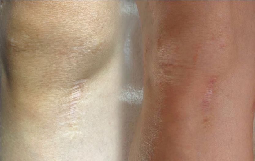 CASE13のBefore After